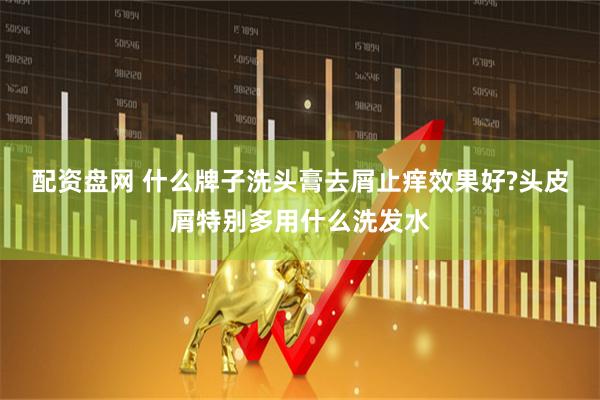 配资盘网 什么牌子洗头膏去屑止痒效果好?头皮屑特别多用什么洗发水